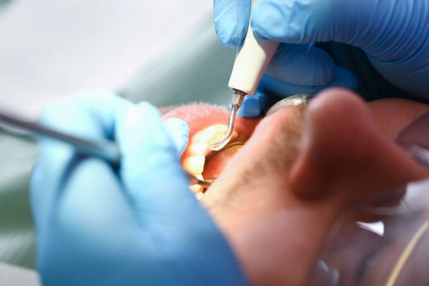 Best Same-Day Emergency Dentist in Arnold Line, MS