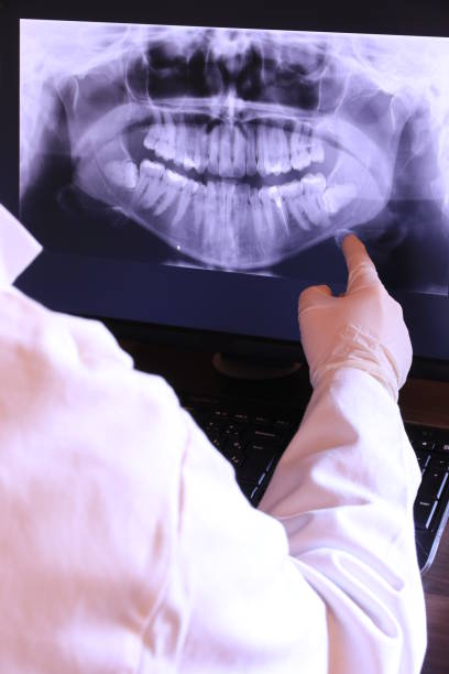 Best Emergency Tooth Extraction in Arnold Line, MS
