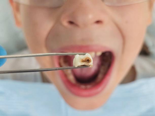Best Walk-In Emergency Dentist in Arnold Line, MS